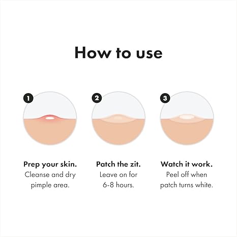 Hydrocolloid Acne Pimple Patch for Covering Zits and Blemishes in Face and Skin, Vegan-friendly and Not Tested on Animals (36 Count)
